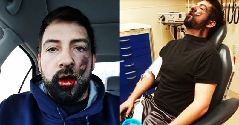 This Horrifying Footage Of An ECigarette Explosion Is Exactly Why You  Should Stay Away From It