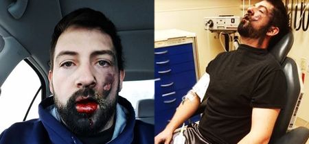 This Horrifying Footage Of An ECigarette Explosion Is Exactly Why You  Should Stay Away From It